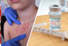 Measles Panic Meets Forensic Pushback Measles Outbreak Takes Deadly Turn as Pennsylvania Reports First U.S. Deaths