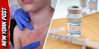 Measles Outbreak Takes Deadly Turn as Pennsylvania Reports First U.S. Deaths