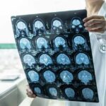 Doctor holding brain MRI scan film