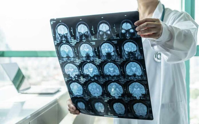 shutterstock_1537198925 Doctor holding brain MRI scan film